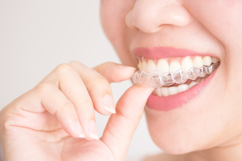 clear aligners for teeth